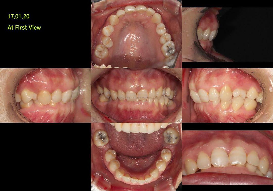 What do you reckon this challenging case??
Do you …